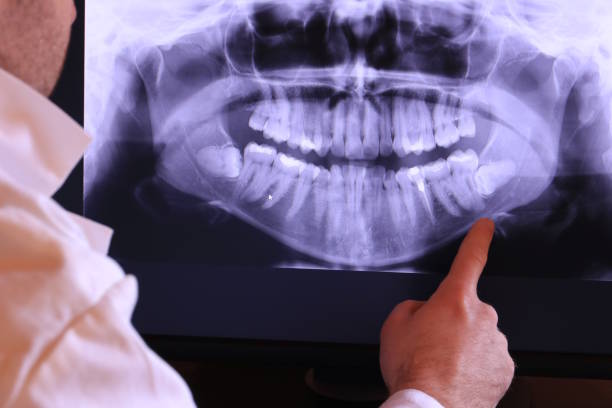 Best Emergency Root Canal Therapy in Ord, NE