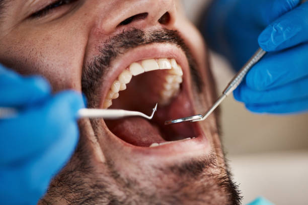 Best Walk-In Emergency Dental Services in Ord, NE